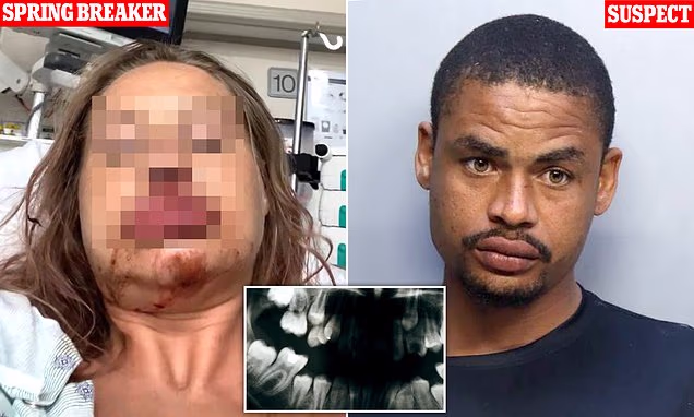 Woman, 25, who was ‘violently raped’ by jailbird illegal migrant speaks out about her terrifying ordeal: ‘No man will ever love me again’